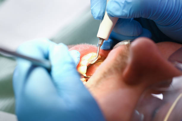 Best Emergency Treatment for Toothache in Hamlet, IN