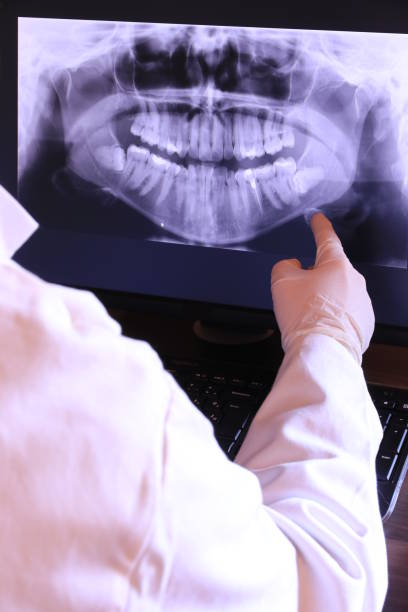 Best Emergency Tooth Extraction in Hamlet, IN